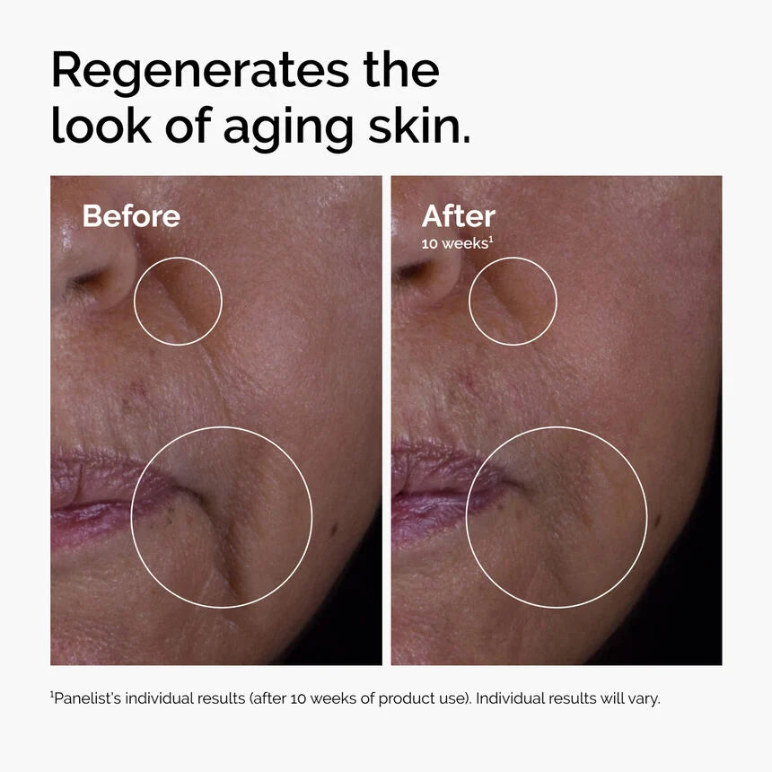 GF 15 % Solution Growth Factor Serum