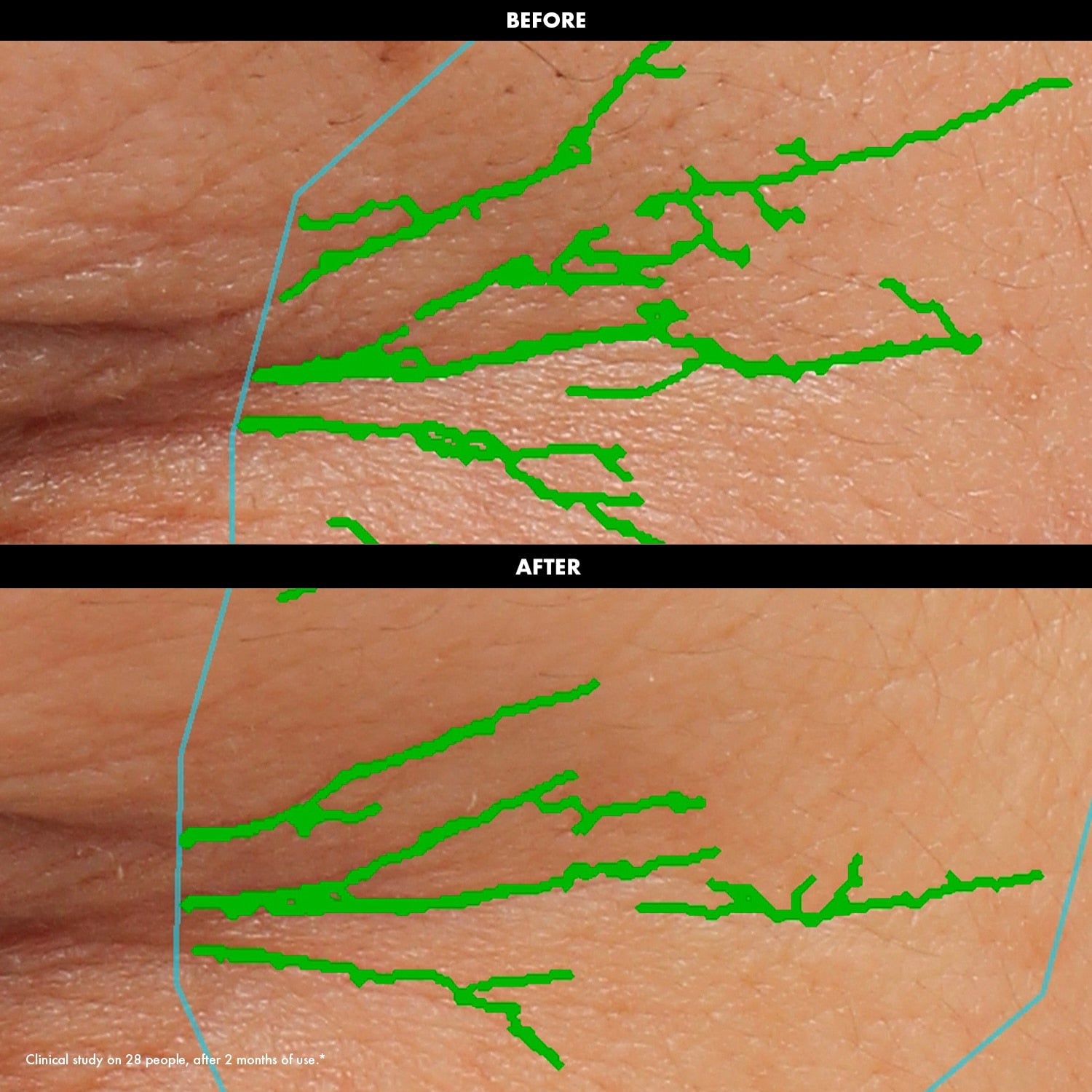 Lift & Firm – Smoothing & Firming Eye Cream