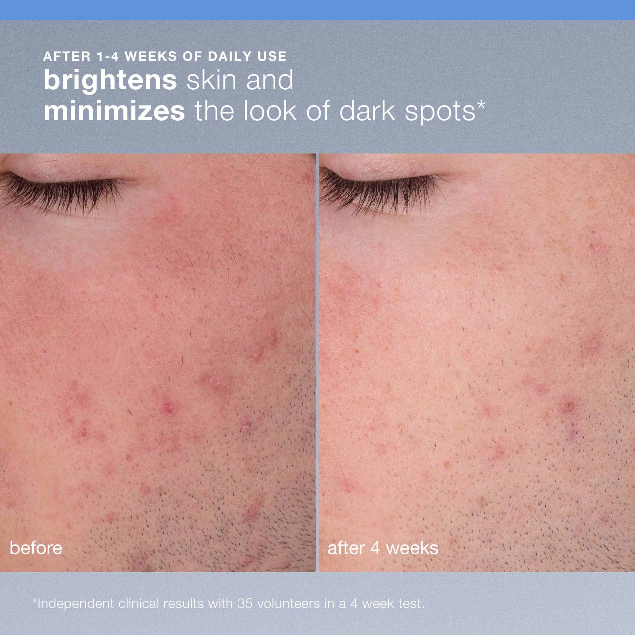 Daily Microfoliant Refillable Exfoliator