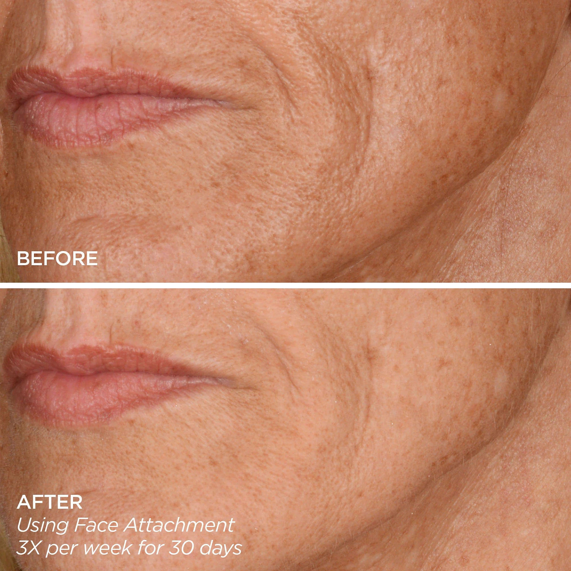 Get That Glow - GloPRO® Microneedling Tool & Discovery Set