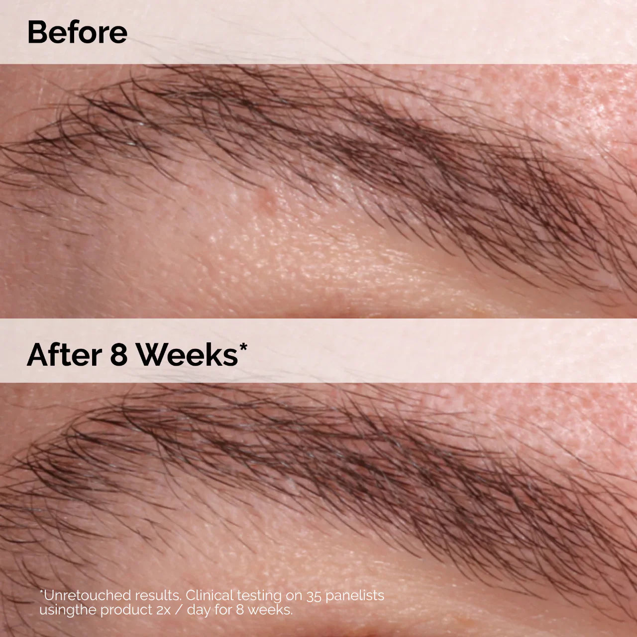 Multi-Peptide Lash and Brow Serum