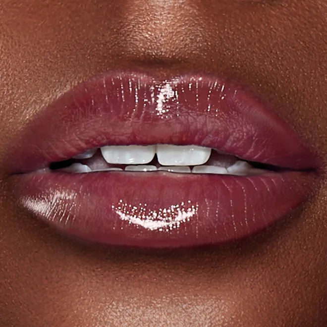 Superstar Lips